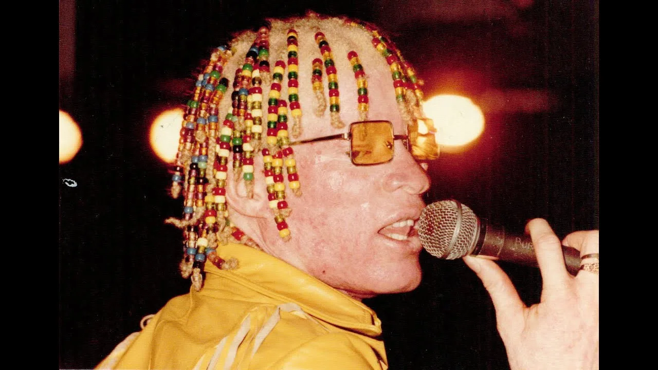 Yellowman: The Legendary Voice Who Helped Define Dancehall